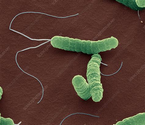 Lbumes Foto Como Eliminar De Ra Z La Bacteria Helicobacter Pylori