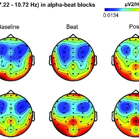 Scalp Distribution Of Eeg Spectral Power During Blocks With