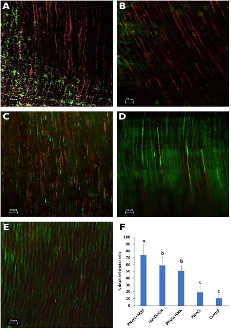 Representative Confocal Microscopy Images Of Bovine Root Dentin