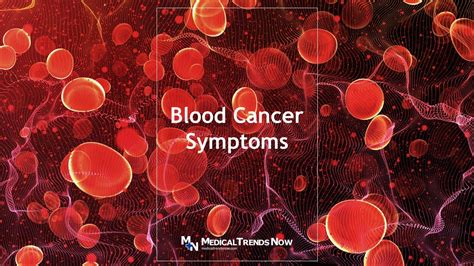 Blood Cancer Symptoms: 10 Warning Signs – Medical Trends Now