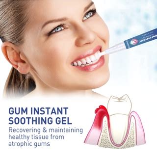 Gum Instant Soothing Gel For Sensitive Teeth Pen Gums Therapy Treatment