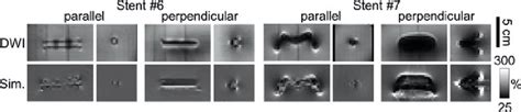 I Comparison Of The Artifacts In Dwi Images B 0 Mm 2 S Top Row