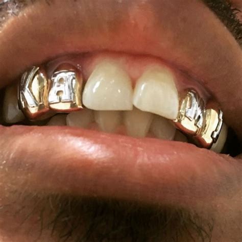 10K Solid Gold 8 Top 8 Bottom Gold Teeth Master