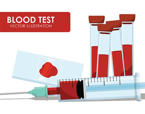 Blood Test Illustrations Royalty Free Vector Graphics And Clip Art Istock