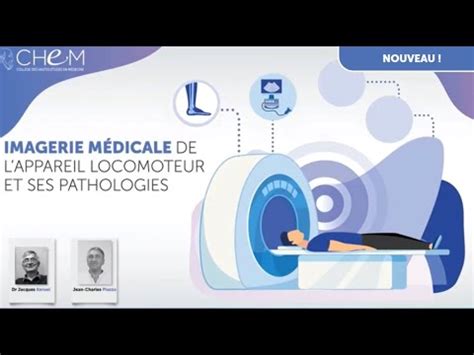 Imagerie médicale de l appareil locomoteur et ses pathologies YouTube