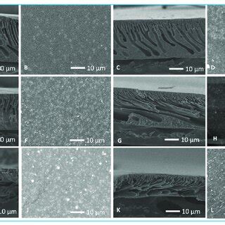 SEM Surface And Cross Section Micrographs Of Nano Engineered Membranes