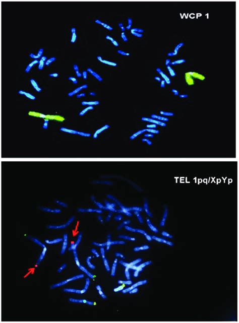 Fluorescent In Situ Hybridization Analysis Showing Heterozygotic Download Scientific Diagram