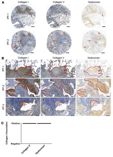 Jci Insight Registration Of The Extracellular Matrix Components