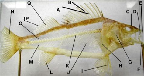 fish bones Diagram | Quizlet