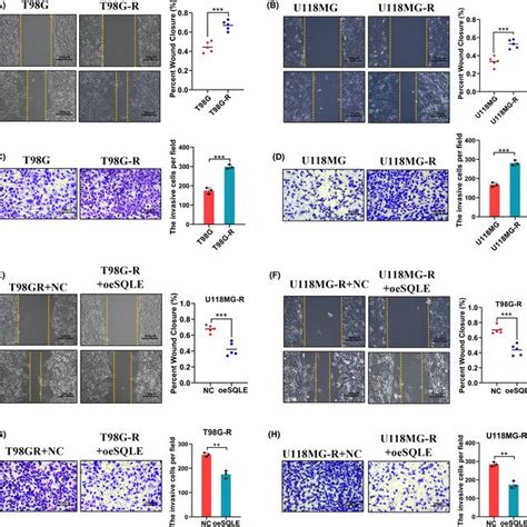 SQLE Inhibits The Migration And Invasion Ability Of GBM A B Wound