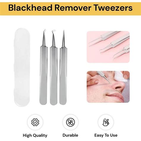 3pcs Blackhead Remover Tweezers Big W