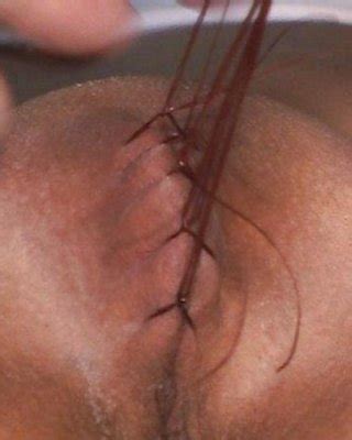 Sewn Up Pussy Porn Pictures XXX Photos Sex Images 416558 PICTOA