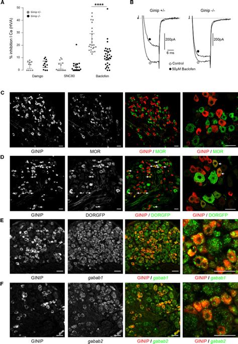 Ginip A G I Interacting Protein Functions As A Key Modulator Of