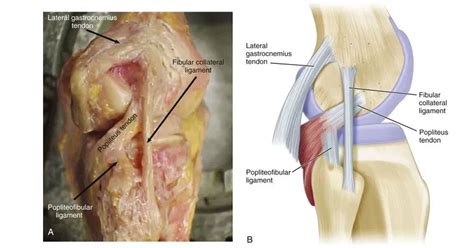 Posterolateral Corner Of The Knee Plc