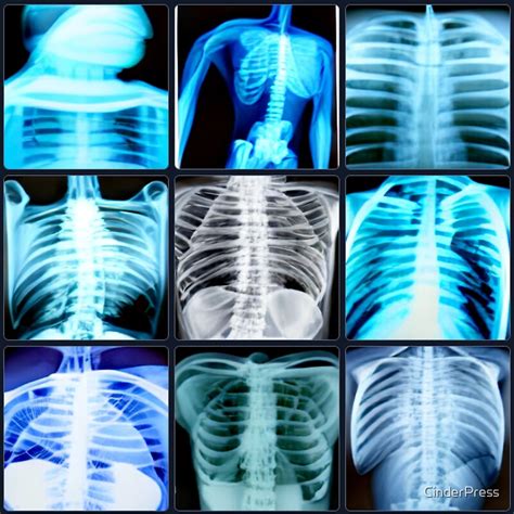 "Radiology / Radiography // X-ray art" by CinderPress | Redbubble