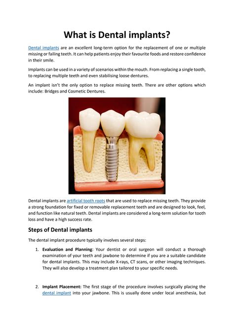 What Is Dental Implants By Denvolve Uk Issuu