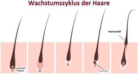 Fallen Transplantierte Haarfollikel Nach Haartransplantation Wieder Aus