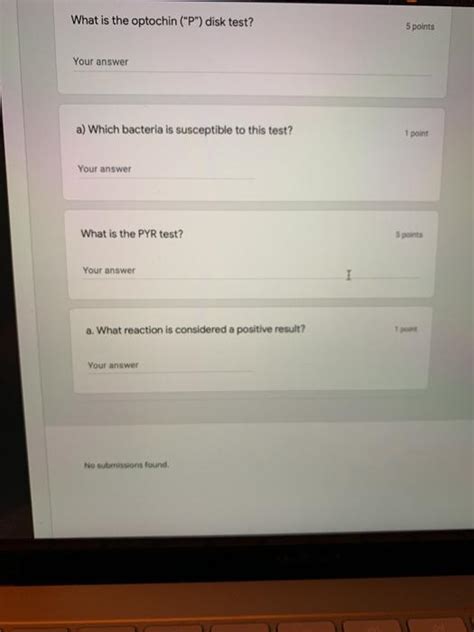 Solved What Is The Optochin P Disk Test Points Your Chegg