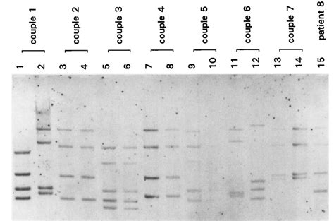 Ribotypes Visualised After Bamhi Digestion Of Dna From P Gingivalis