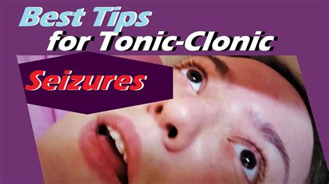 Tonic Clonic Generalized Grand Mal Seizure Packed With Epilepsy Tips