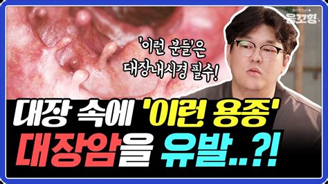 사망률 3위 대장암 이런 사람은 잘 걸릴 수 있습니다ㅣ용종과 선종으로부터 대장 사수하는 법 Youtube