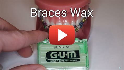 Braces Wax YouTube