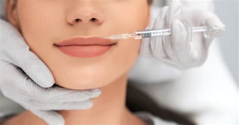 Preenchimento Labial Tudo Sobre O Procedimento O Que é Como é Feito