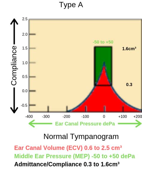 Tympanometry ¦ Middle Ear Test ¦ Hearing Test ¦ Audio Tests