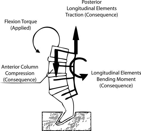 Biomechanical Evaluation Of Pedicle Screw Based Dynamic Stabilization