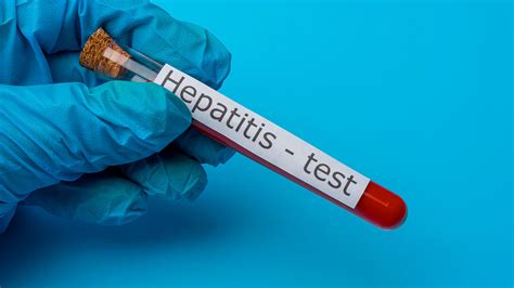 Argentina Detecta Primer Caso De Hepatitis Infantil Aguda En Latam