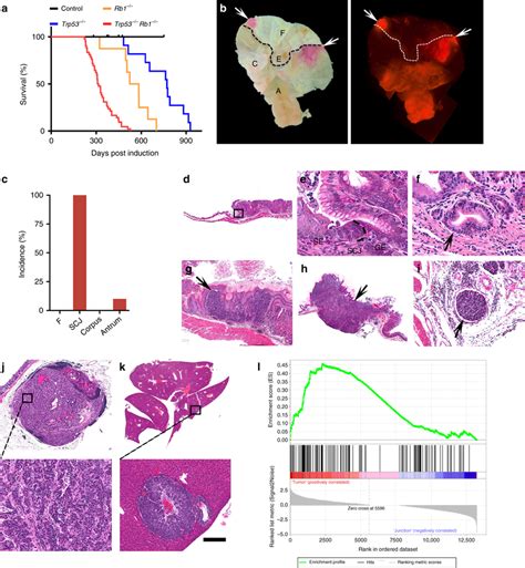 Inactivation Of Trp And Rb In Lgr Cells Leads To Preferential