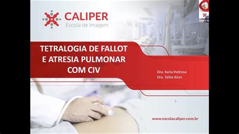 Tetralogia De Fallot E Atresia Pulmonar CIV YouTube