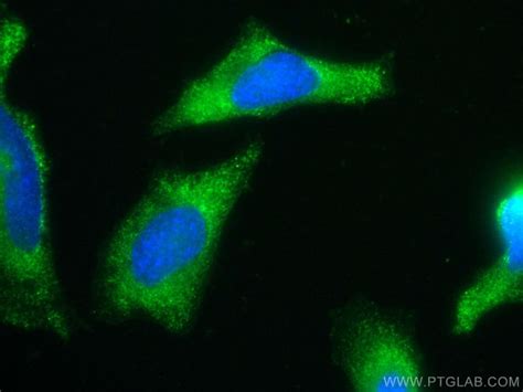 hIST1 Monoclonal Antibody 1E12A7 CoraLite488 Proteintech 100 μL