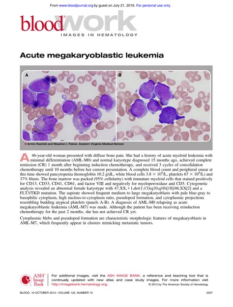 Pdf Acute Megakaryoblastic Leukemia