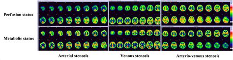 Clinical And Neuroimaging Correlates Among Cohorts Of Cerebral