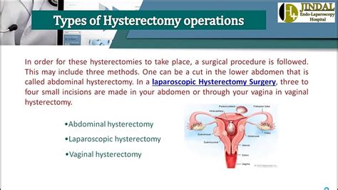 Laparoscopic Assisted Vaginal Hysterectomy Surgery Dr Jindal Youtube