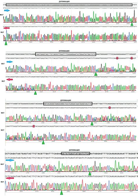 Chromatograms Of The Flt Itd Insertion Site Sequencing In Samples No