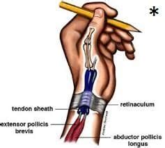 Sindrome Di De Quervain Un Dolore Al Pollice Intenso