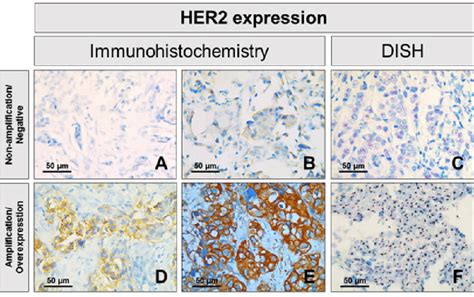 Immunohistochemical Ihc And Dual Color In Situ Hybridization Dish