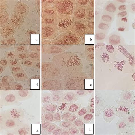 Chromosomal Aberrations In A Cepa Root Tip Meristematic Cells A Download Scientific Diagram