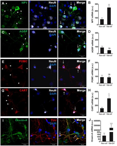 Hypothalamic Neurospheres Differentiate To Mature Neurons Expressing