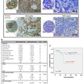 Immunohistochemical Analysis Of SOX2 Expression In Sarcoma Patients And