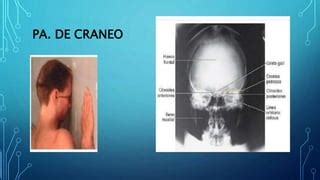 3 Proyecciones Radiograficas De DE CRANEO Pptx