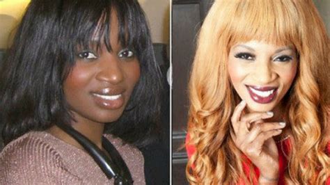 Skin Bleaching In Africa A Risky Addiction Daily Monitor