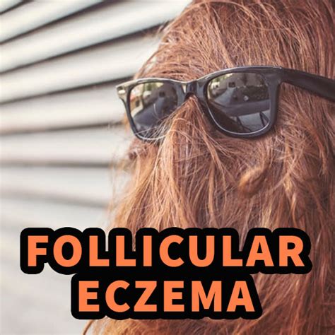 Follicular Eczema - An overview and what to do...