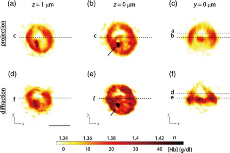 RI Maps Of A Pf RBC At The Trophozoite Stage A C X Y Cross Sectional