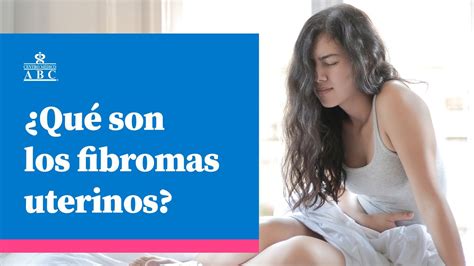 ¿qué Son Los Fibromas Uterinos Youtube