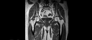 Mrt H Fte Praxis F R Radiologische Diagnostik Hanau