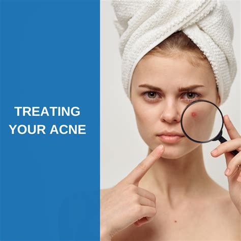 Treating Your Acne At Savannah River Dermatology Savannah River