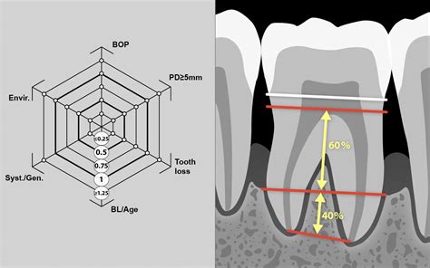 Perio Tools Your Online Portal For Periodontal Tools